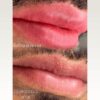 Micropigmentcion labios para hombre