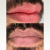 Micropigmentcion labios para hombre