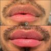 Micropigmentcion labios para hombre