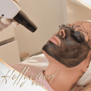 Hollywood Láser Peel